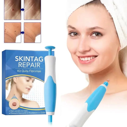 Kit Indoloro de Remoción de Fibromas en Casa
