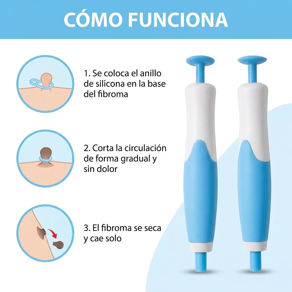 Kit Indoloro de Remoción de Fibromas en Casa
