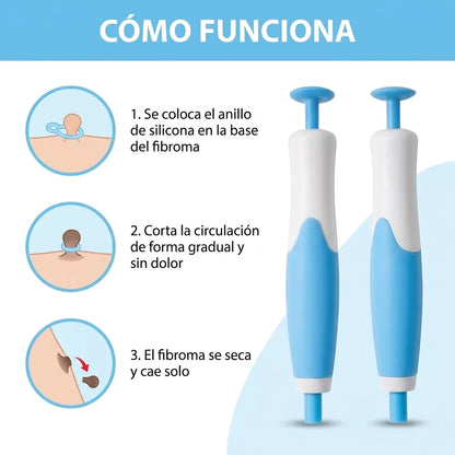 Kit Indoloro de Remoción de Fibromas en Casa